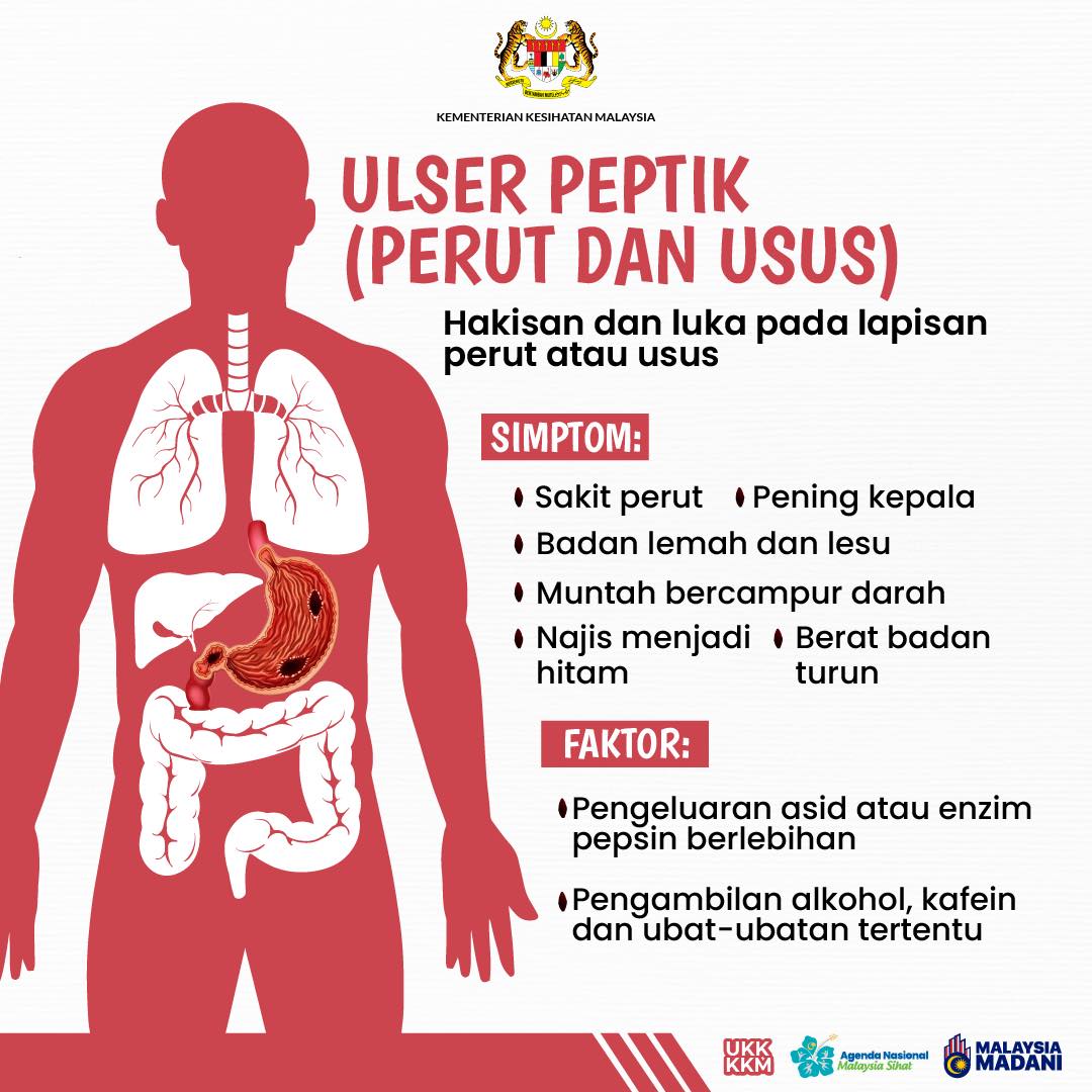 Laporan akhbar gastrik dan GERD